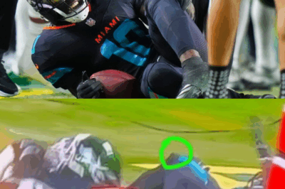 Shocking New Image Reveals Tyreek Hill’s Bone Popping Out of His Leg Following Devastating Injury During Game