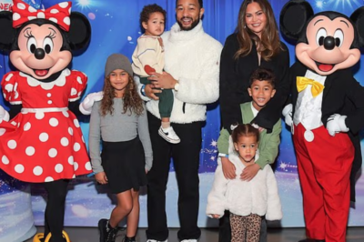 Chrissy Teigen reveals chipped tooth after candy cane game mishap with her kids