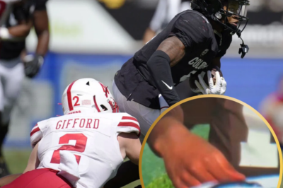 HORRIFYING CLOSE-UP: You HAVE to see the gruesome state of Shedeur Sanders’ injured hand. His finger is literally DISFIGURED.