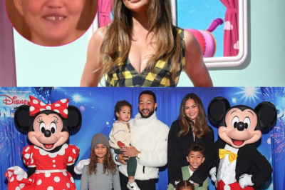 Chrissy Teigen gets tooth FIXED in time for Christmas after chipping it in candy cane mishap