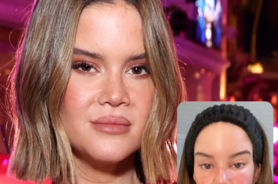 Maren Morris suffered severe facial swelling (the worst she’d ever experienced) before her New Year’s Eve performance!