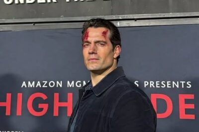 Henry Cavill injured on Highlander set forcing production delay until 2026 Amazon MGM takes over