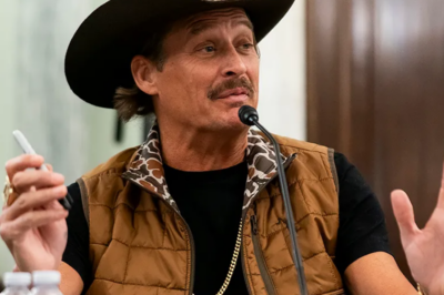 Kid Rock’s haggard looks is due to one major thing as cosmetic surgery secret are exposed