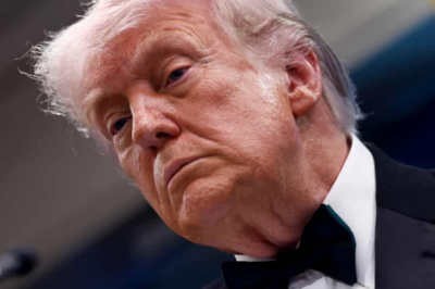 ‘He’s Decomposing’: Donald Trump’s ‘Bruised’ Hands Fuel Medical Panic During King Charles State Visit